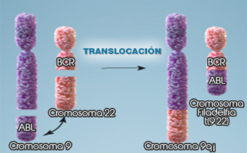 Leucemia Mieloide - Crónica