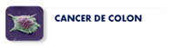 Cáncer de Colon