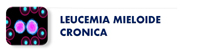 Leucemia Mieloide Crónica