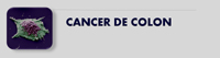 Cáncer de Colon