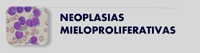 Neoplasias Mieloproliferativas